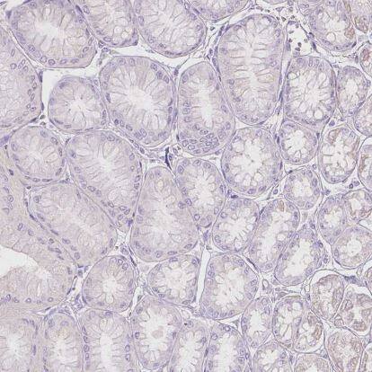 Galactose-3-O-sulfotransferase 2/GAL3ST2 Antibody