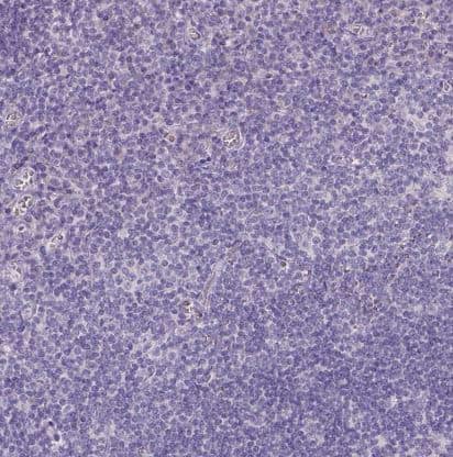 Galactose-3-O-sulfotransferase 2/GAL3ST2 Antibody