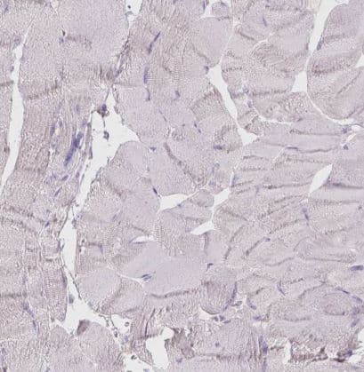 Galactose-3-O-sulfotransferase 2/GAL3ST2 Antibody