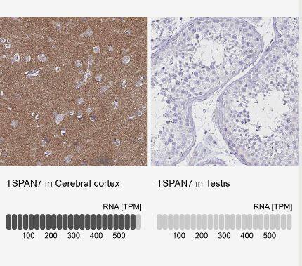 TSPAN7/TM4SF2 Antibody (CL0262)