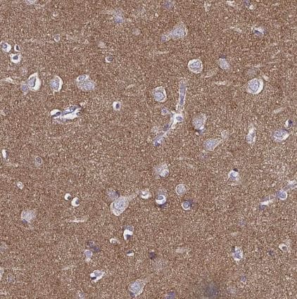 TSPAN7/TM4SF2 Antibody (CL0262)