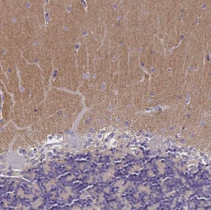 TSPAN7/TM4SF2 Antibody (CL0262)