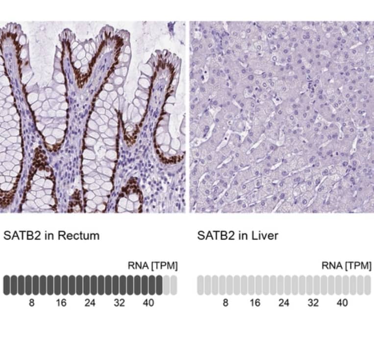 SATB2 Antibody (CL0323) - BSA Free