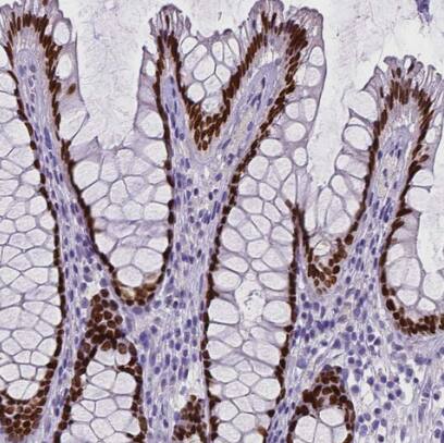 SATB2 Antibody (CL0323) - BSA Free