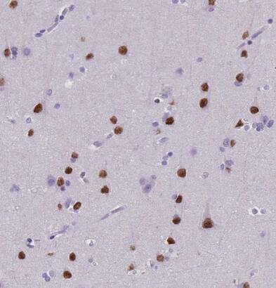 SATB2 Antibody (CL0323) - BSA Free