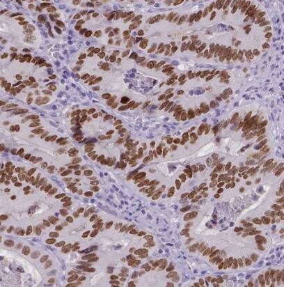 SATB2 Antibody (CL0323) - BSA Free