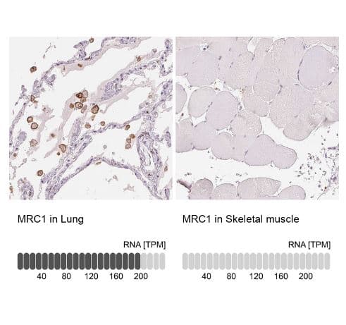 MMR/CD206/Mannose Receptor Antibody (CL0387)