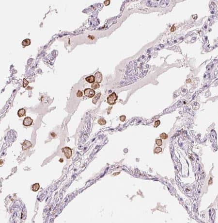 MMR/CD206/Mannose Receptor Antibody (CL0387)