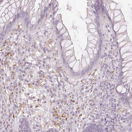 MMR/CD206/Mannose Receptor Antibody (CL0387)