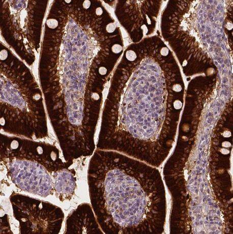 Apolipoprotein A-IV/ApoA4 Antibody (CL0468)