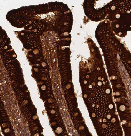 Apolipoprotein A-IV/ApoA4 Antibody (CL0468)