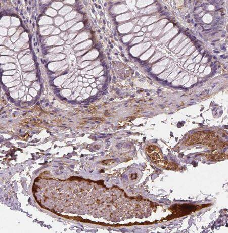 Apolipoprotein A-IV/ApoA4 Antibody (CL0468)