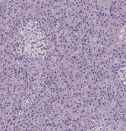 Apolipoprotein A-IV/ApoA4 Antibody (CL0468)