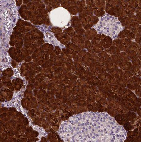 PHGDH Antibody (CL0555)