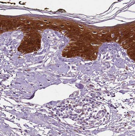PHGDH Antibody (CL0555)