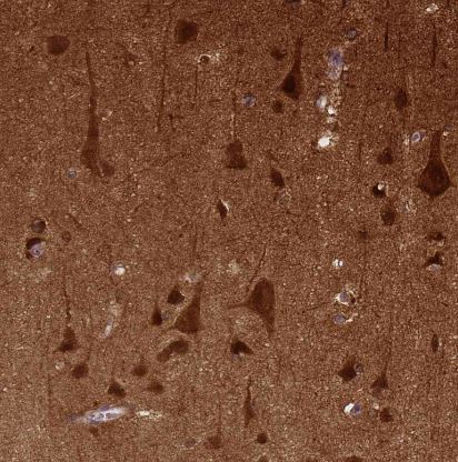 NECAB1 Antibody (CL0575)