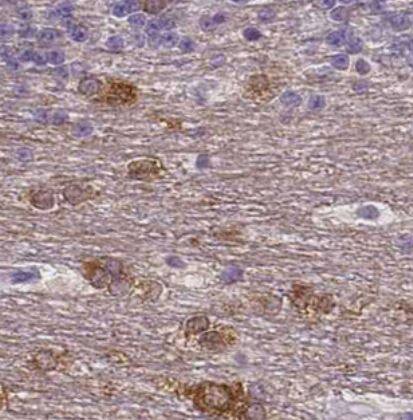 NECAB1 Antibody (CL0575)