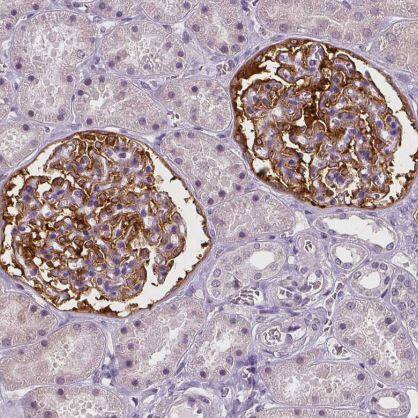 NECAB1 Antibody (CL0575)