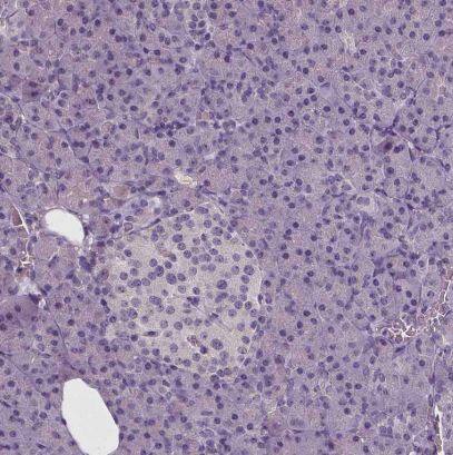 NECAB1 Antibody (CL0575)