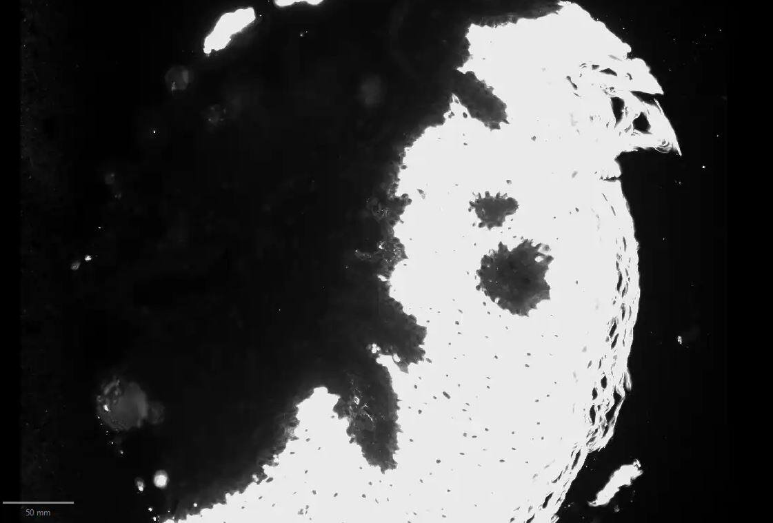 Cytokeratin 10 Antibody (SPM623) - Azide and BSA Free