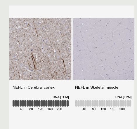 NF-L Antibody