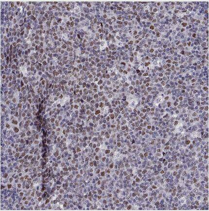 BACH1 Antibody