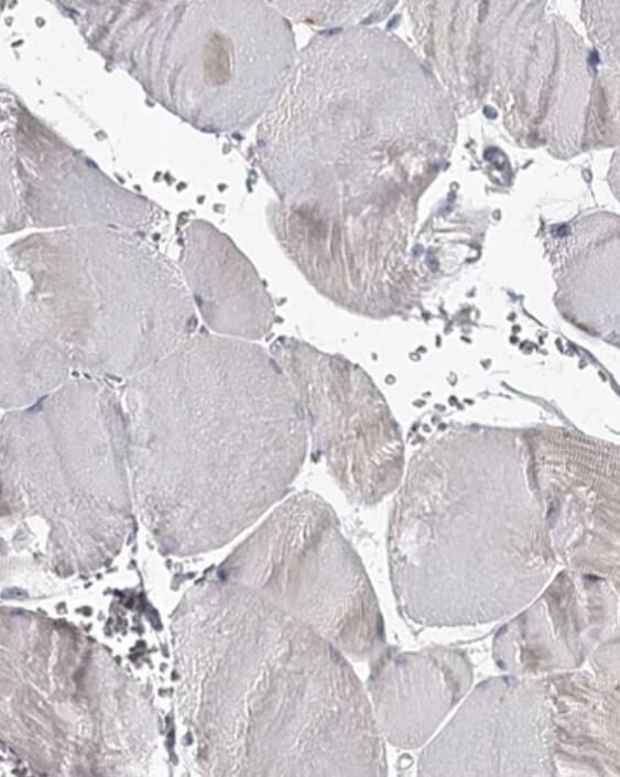 RASSF6 Antibody - BSA Free