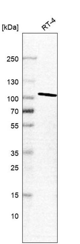 STRN4 Antibody Western Blot: STRN4 Antibody [NBP2-55532]