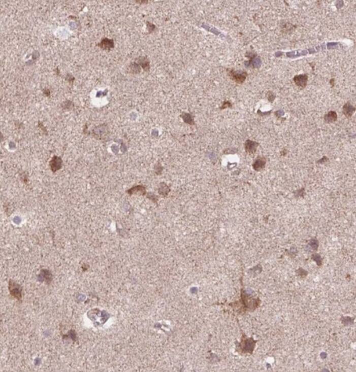 Frizzled-7 Antibody - BSA Free