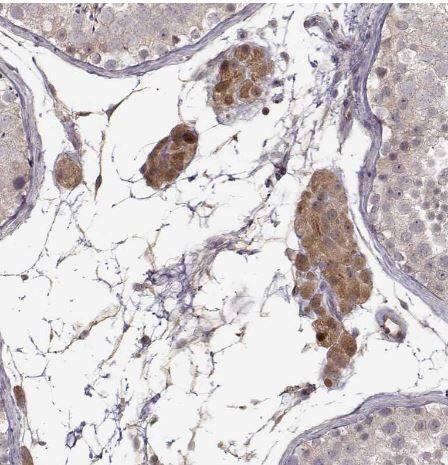 CRB1 Antibody CRB1 Antibody