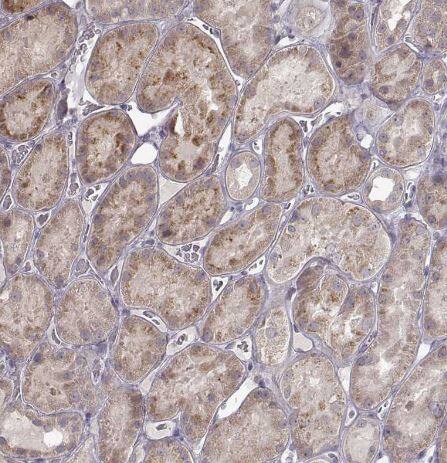 CRB1 Antibody CRB1 Antibody