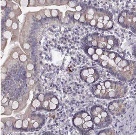 CRB1 Antibody CRB1 Antibody
