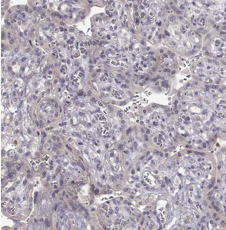 CRB1 Antibody CRB1 Antibody