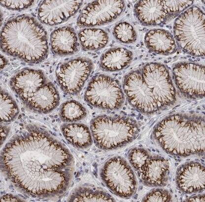 YIPF3 Antibody