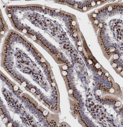 YIPF3 Antibody