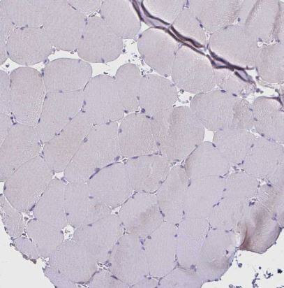 Bestrophin 1 Antibody