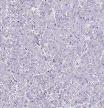Bestrophin 1 Antibody