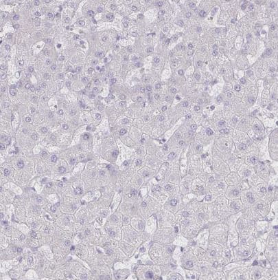 Bestrophin 1 Antibody