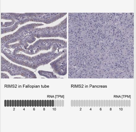 RIMS2 Antibody