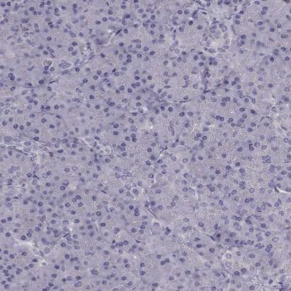 RIMS2 Antibody