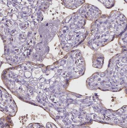 NAALADase-2/NAALAD2 Antibody