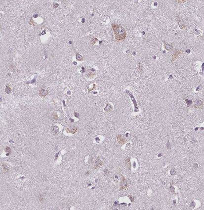 NAALADase-2/NAALAD2 Antibody