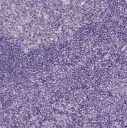 NAALADase-2/NAALAD2 Antibody
