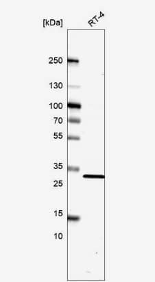 TMEM81 Antibody