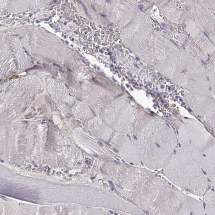 LINGO-1 Antibody - BSA Free