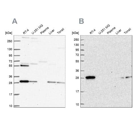 PMM2/Phosphomannomutase 2 Antibody