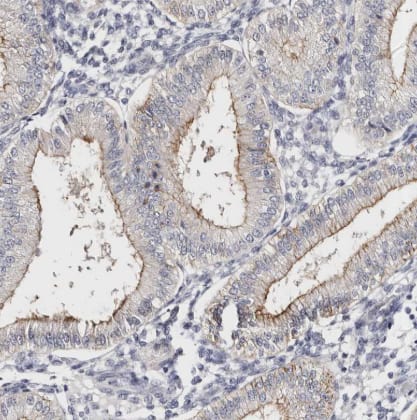 ROM1 Antibody