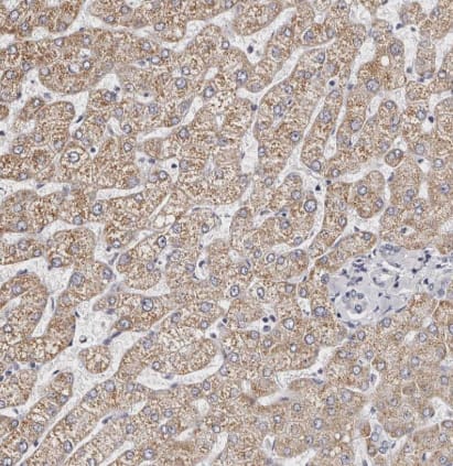 ROM1 Antibody