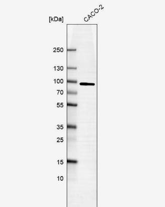 PFKP Antibody