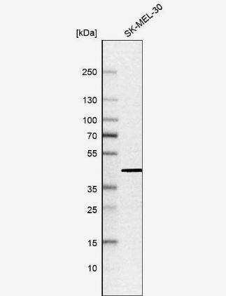 ATP6V1C1 Antibody
